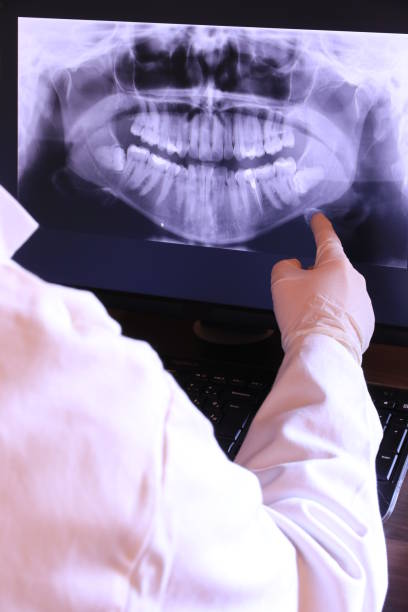 Best Knocked-Out Tooth Emergency  in Lower Lake, CA