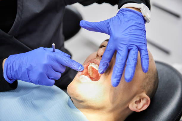 Best Chipped Tooth Repair Near Me  in Lower Lake, CA